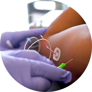 Electrodiagnostics Special Interest Group Electrodiagnostics Special Interest Group