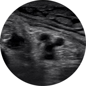 Neuromusculoskeletal Ultrasonography (NMSKUS SIG) Neuromusculoskeletal Ultrasonography (NMSKUS SIG)