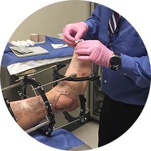 Wound Management - Special Interest Group Wound Management - Special Interest Group